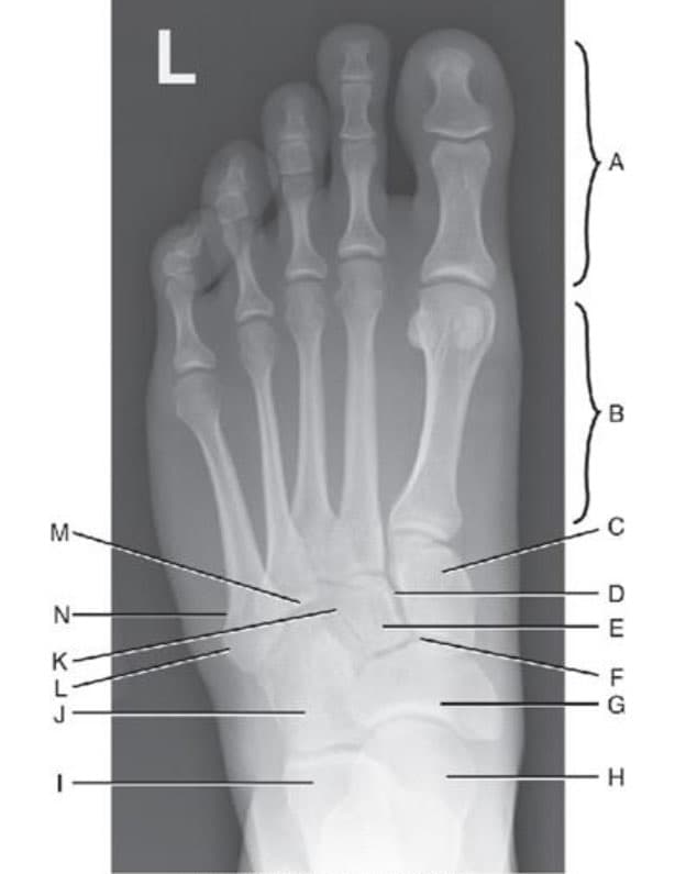 AP Foot