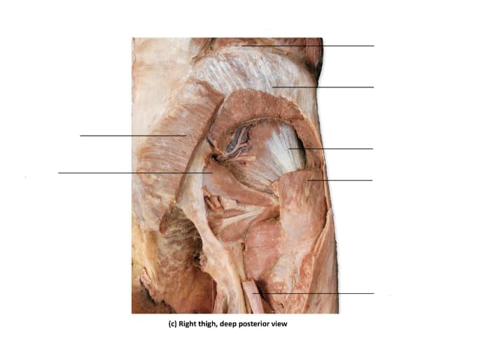 Right thigh, posterior veiw
